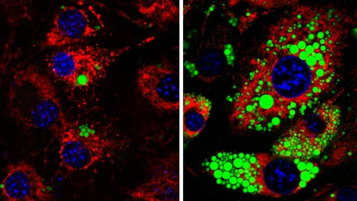 Turning Off One Protein Made Mice Immune to Obesity. Scientists Just Tested It on Human Cells : ScienceAlert