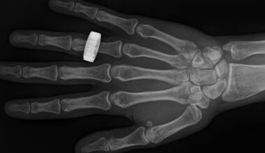 These Look Like Ordinary X-Rays. They're Not