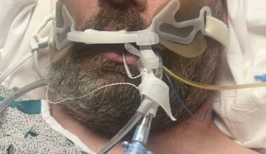 Temple University Hospital seeks help identifying a patient.
