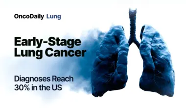 Early-Stage Lung Cancer Diagnoses Rise Across the United States