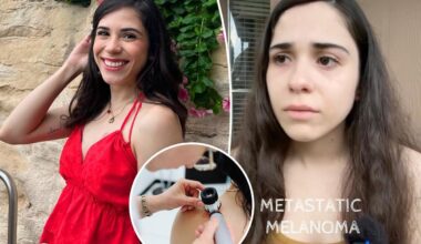 26-year-old shares warning just months before dying of melanoma