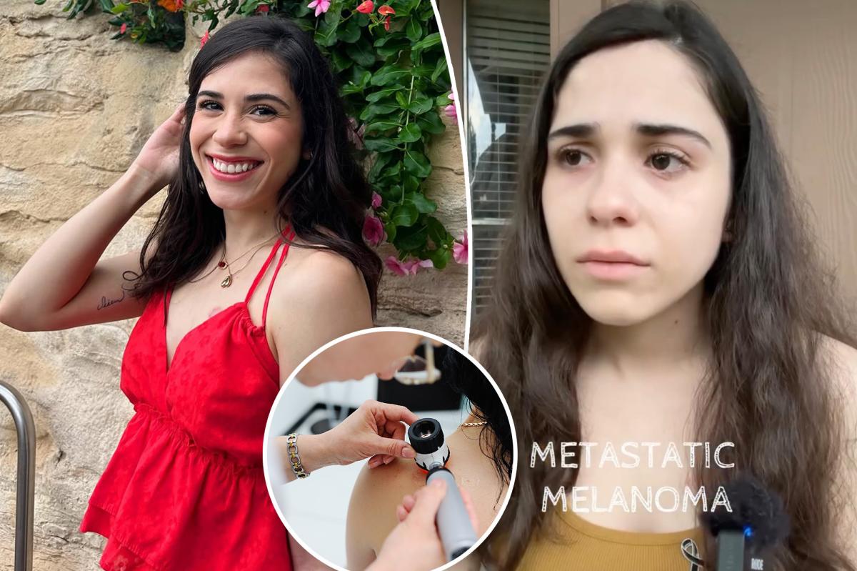 26-year-old shares warning just months before dying of melanoma