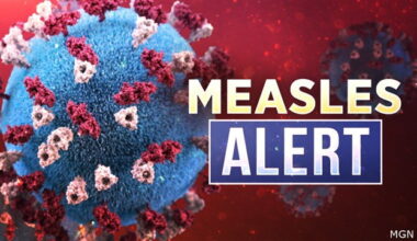 Three measles exposure locations identified in Oregon, OHA urging public to speak to health care provider