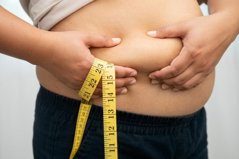 Obesity Hands Holding Belly Fat Weight Loss Struggle