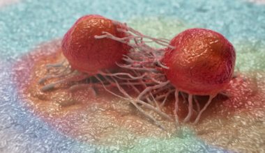 Drug Stops 90% of Pancreatic Cancer Migration in Lab Tests : ScienceAlert