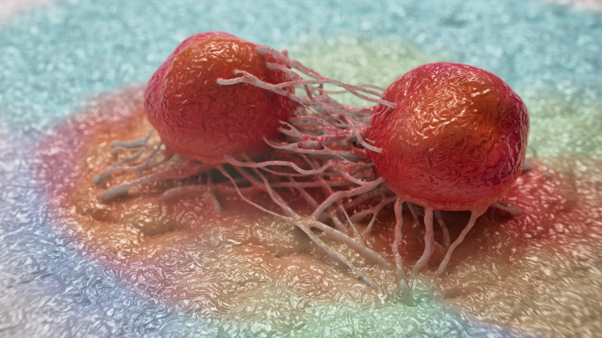 Drug Stops 90% of Pancreatic Cancer Migration in Lab Tests : ScienceAlert