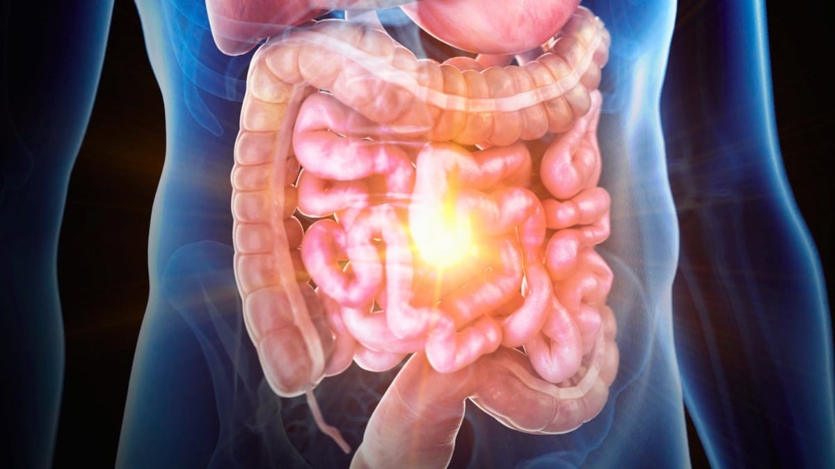 Inflammatory Bowel Disease Has Been Recreated on a Chip, And Scientists Could Finally Figure Out Its Cause : ScienceAlert