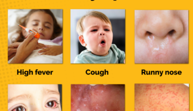 UPDATE: Health Officials Confirm Multiple Measles Cases in St. Mary's County; Possible Exposure at Three Locations Announced - Southern Maryland News Net