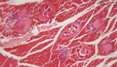 Tainted Jerky Caused an Outbreak of Bear Worms