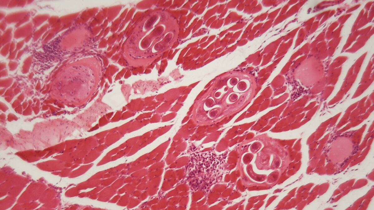 Tainted Jerky Caused an Outbreak of Bear Worms