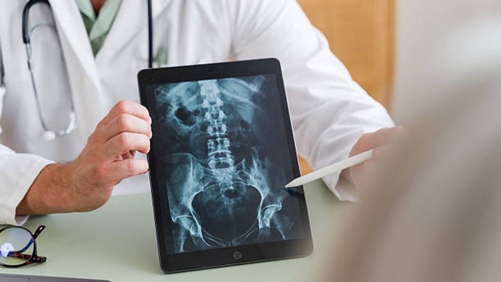 Healthcare professional examines a patient's spinal X-ray on a tablet, highlighting advanced medical technology and diagnostic practices in modern healthcare