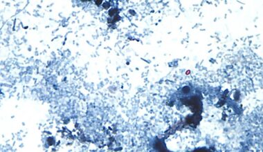 Cyclospora cases have been reported in several states. What to know about the diarrhea-causing parasite.