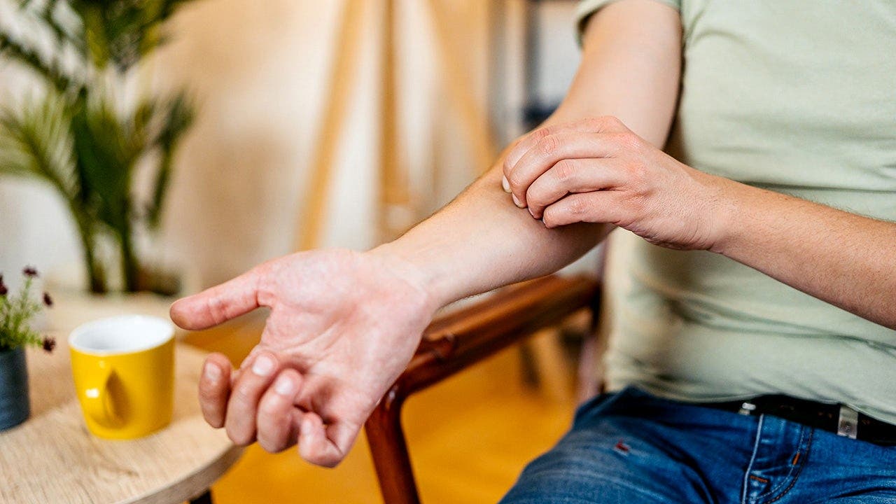 Scratching an itch worsens eczema and skin inflammation, study finds