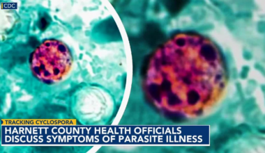 Tracking Cyclosporiasis: 30 more in Wake diagnosed with diarrhea-causing bug :: WRAL.com