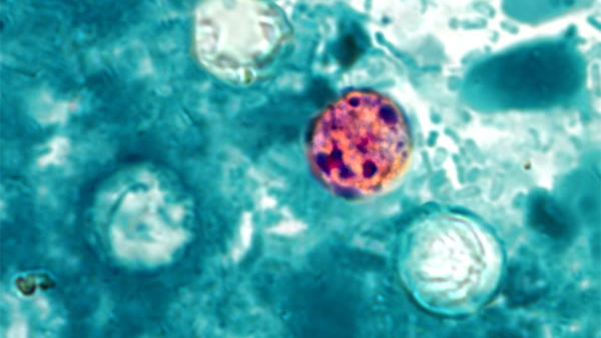 CDC tracks cyclospora cases in Pennsylvania