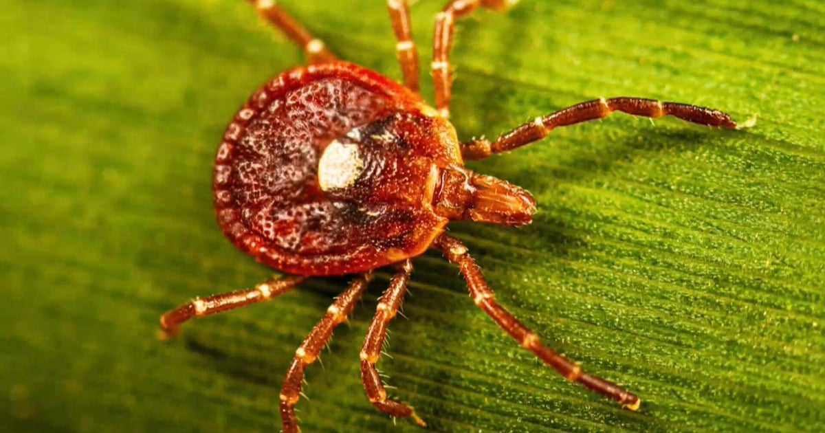 Tick season is expected to be worse than normal as ER visits rise in much of the U.S.
