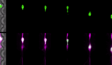 Neuronal migration is risky, DNA-breaking business