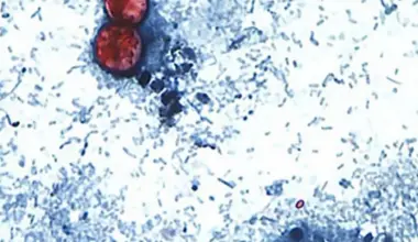 25 people have diarrhea-causing parasite in Johnson County