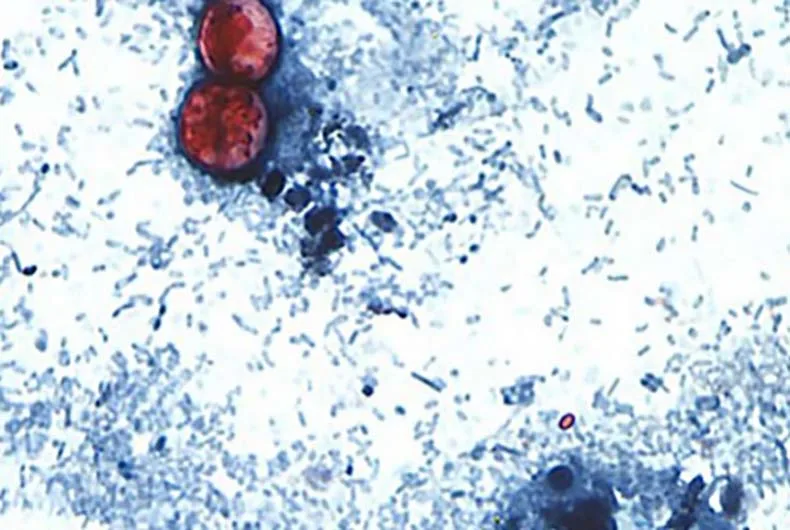 25 people have diarrhea-causing parasite in Johnson County