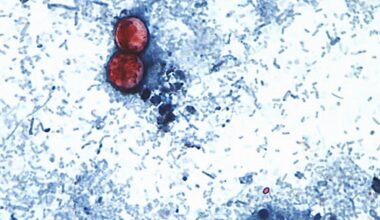 cyclospora taylor farms false positive