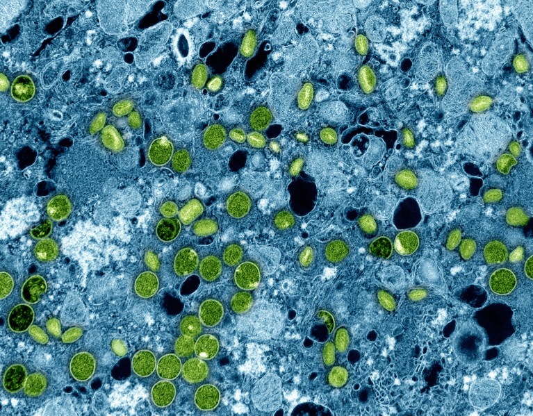 A coloured transmission electron micrograph of circular green monkeypox virus particles within blue cultured cells