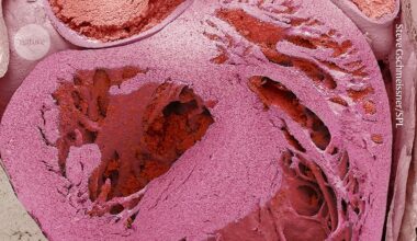 The heart has a ‘little brain’ — and it protects against stress