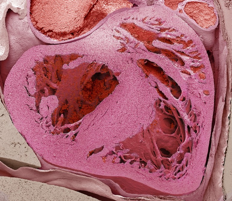 Coloured scanning electron micrograph of a mouse embryo heart cross-section, showing internal chambers and tissue structures in shades of pink and red