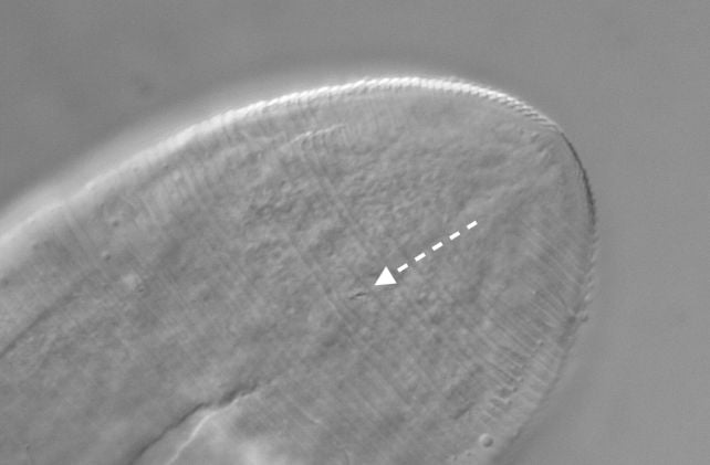 Skin Mites That Mate on Our Faces at Night Are Starting to Merge With Humans