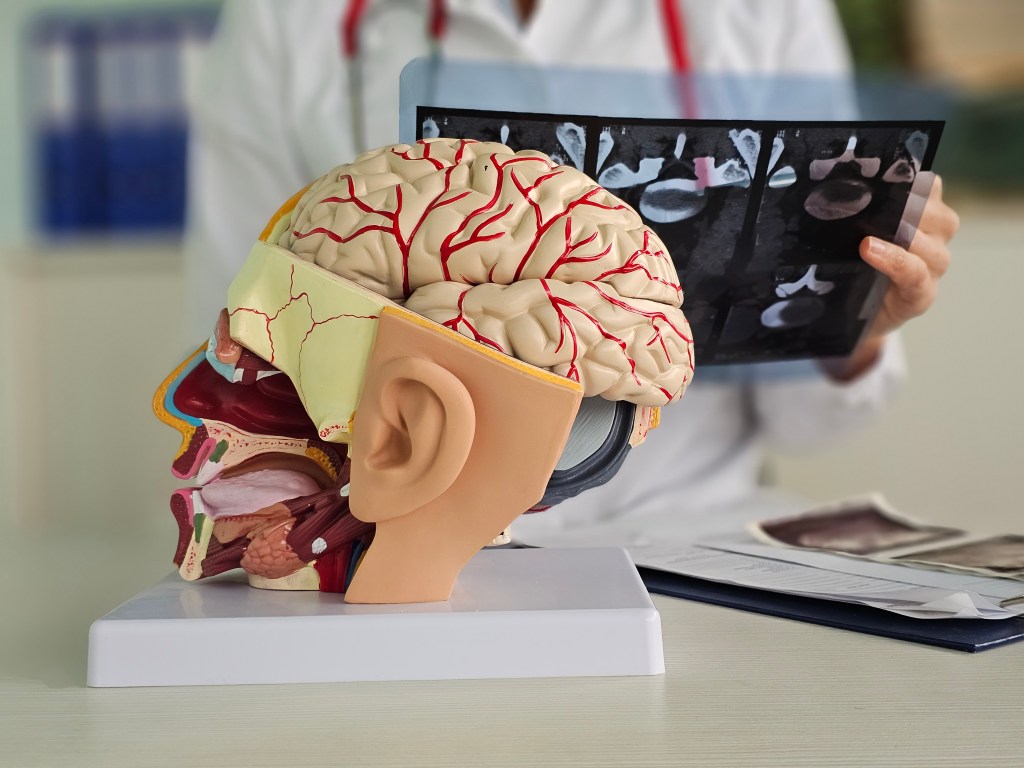 Doctor with a stethoscope holding a brain scan over a model of a human brain.