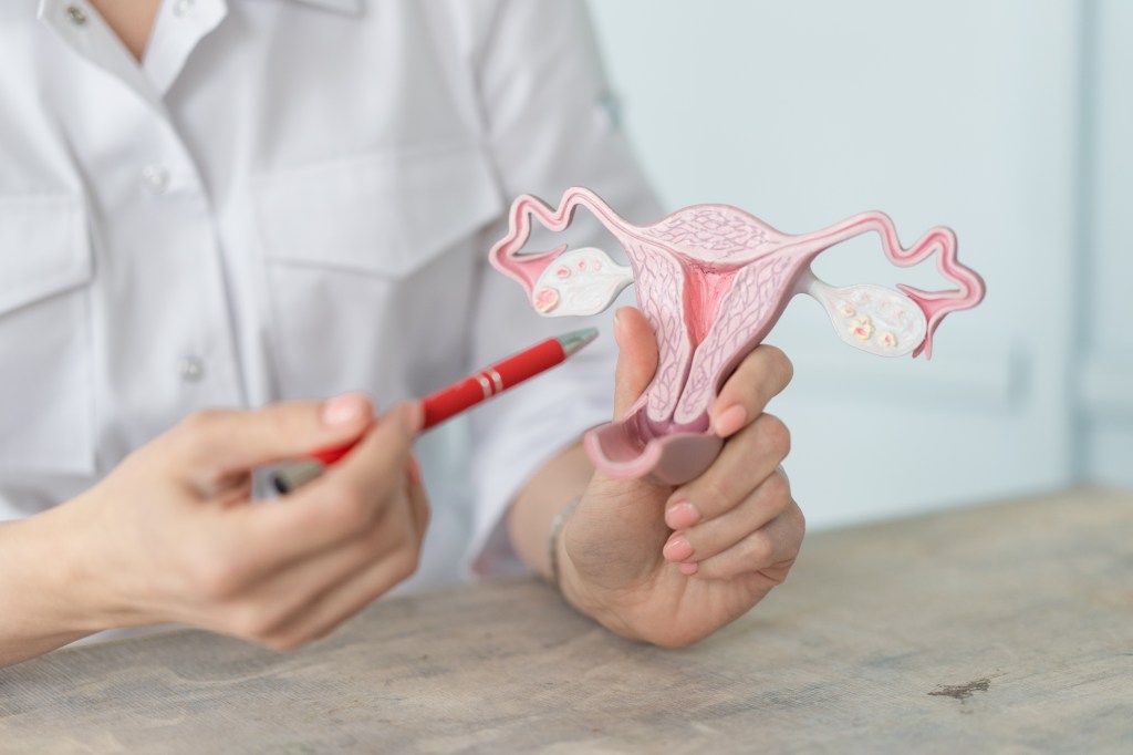 A doctor pointing to a medical model of a female uterus with a red pen.