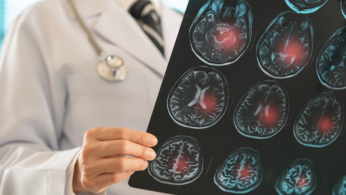 Doctor examining brain x-ray image in hospital setting