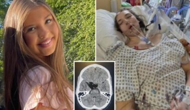 Teen's 'dehydration' headaches in heatwave were signs of ruptured tumor