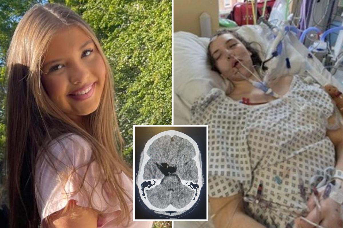 Teen's 'dehydration' headaches in heatwave were signs of ruptured tumor