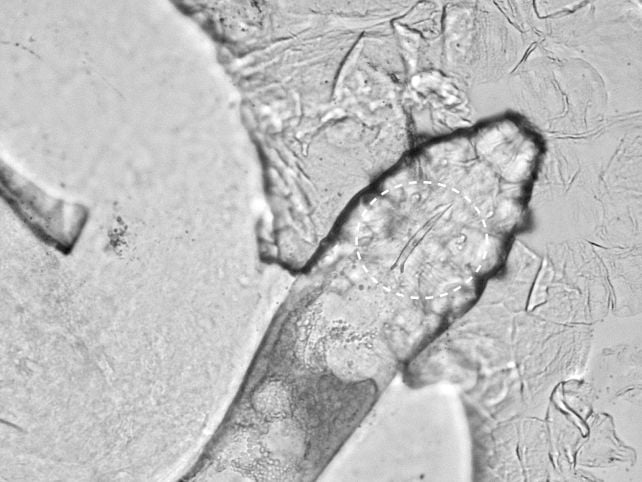Skin Mites That Mate on Our Faces at Night Are Starting to Merge With Humans