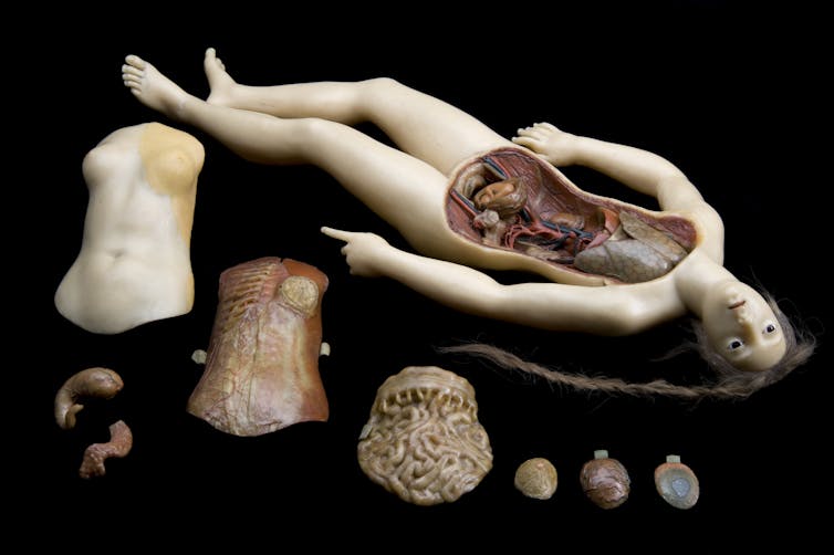 A reclining woman, her torso open in four layers.