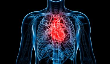 Senator Lindsey Graham just died of aorta disease. My husband did too.
