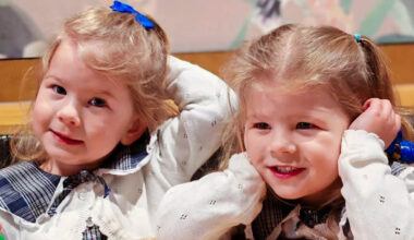 Pioneering treatment saves identical twins from rare pregnancy condition
