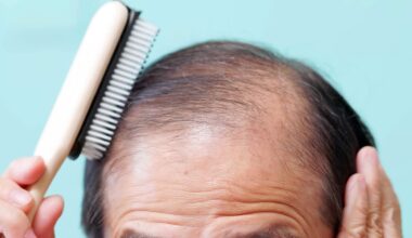 Weight loss drugs linked to loss of hair in major new study