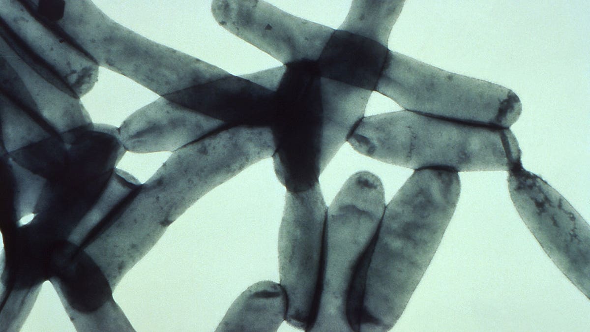 Legionella pneumophila bacteria reproduce in a magnified electron micrograph.