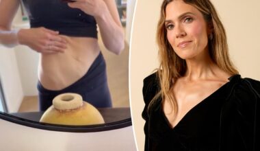 Mandy Moore gives unfiltered look at postpartum body, 'loose skin' after 3 kids