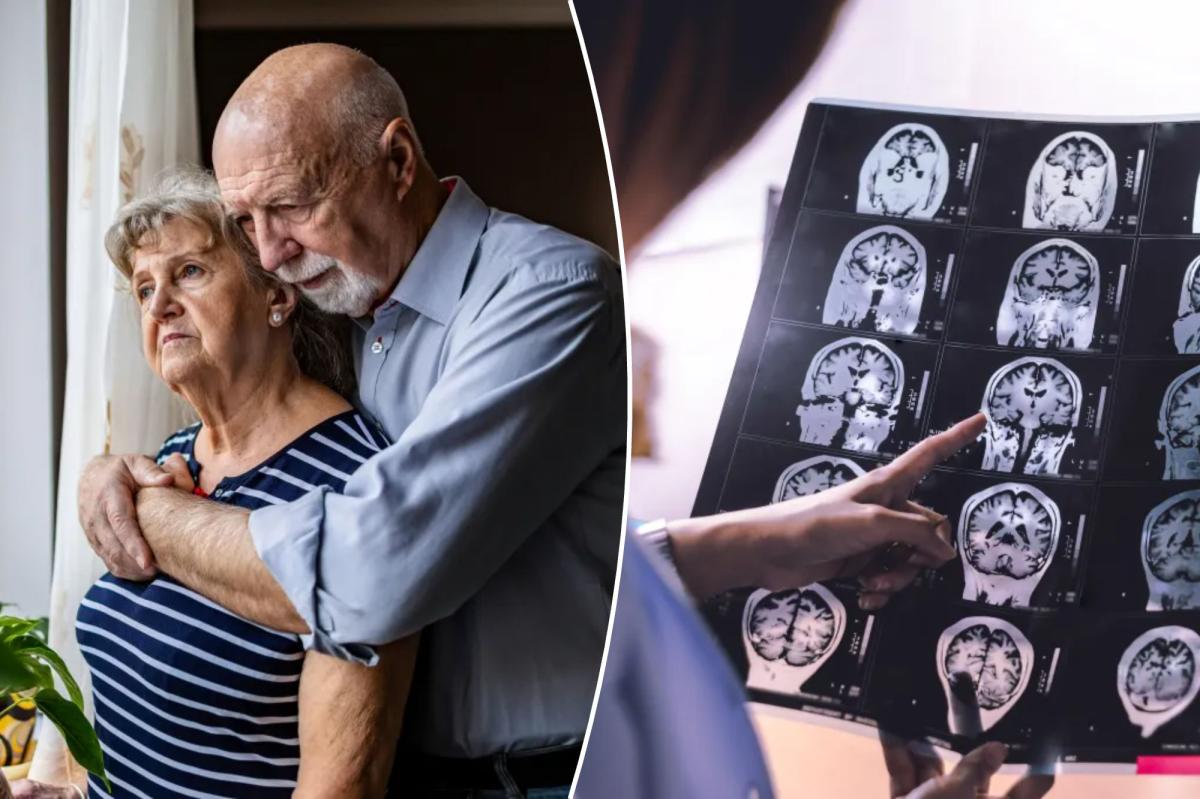 Your husband (or wife) may increase your risk of dementia