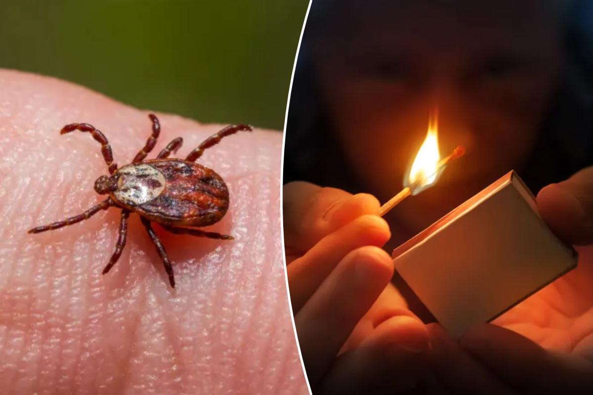Tick-removal tricks: what works and what to skip