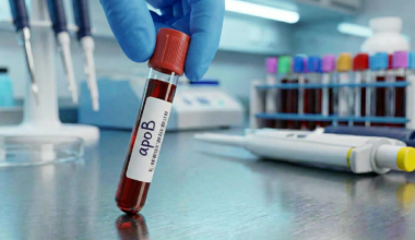 Are You Getting The Wrong Cholesterol Test? Study Says Your Standard Test May Miss Heart Attack Risks