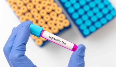 Cases of Legionnaires' Disease on Manhattan's Upper East Side jumps to 10: NYC health officials