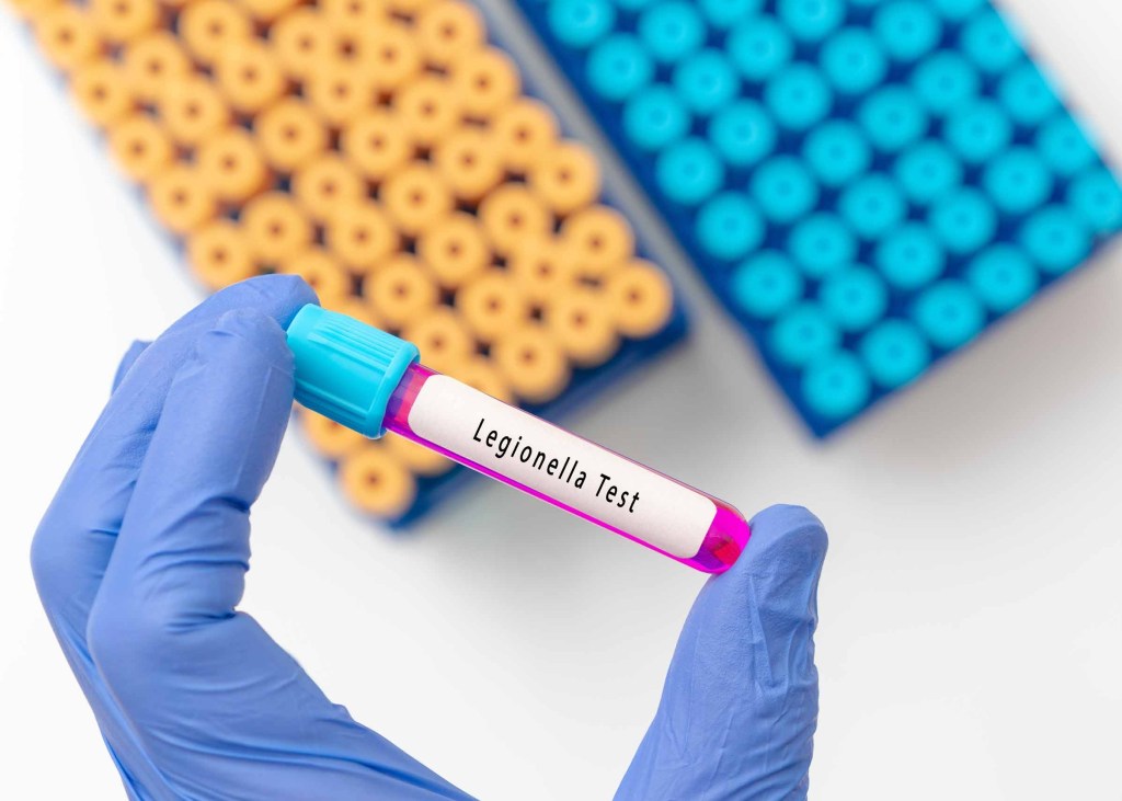 Cases of Legionnaires' Disease on Manhattan's Upper East Side jumps to 10: NYC health officials