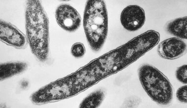 What to know about the Legionnaires' disease outbreak in NYC