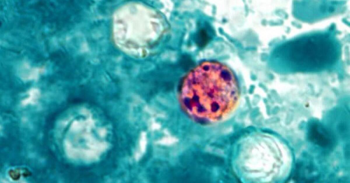 What to know about the Diarrhea-causing parasite spreading in the U.S.