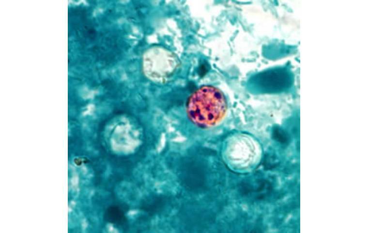 CDC
Cyclospora cayetanensis oocysts. The state Department of Health has confirmed two additional cases of cyclosporiasis in Hawaii residents who became infected while traveling outside the state, bringing the total number of confirmed cases reported in Hawaii this year to three.