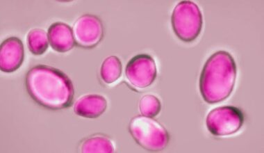 Drug-resistant fungus on the radar in Michigan as health experts monitor spread