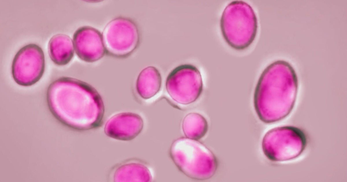 Drug-resistant fungus on the radar in Michigan as health experts monitor spread